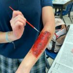 anatomy wounds