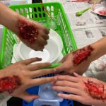 anatomy wounds