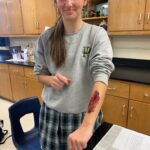 anatomy wounds